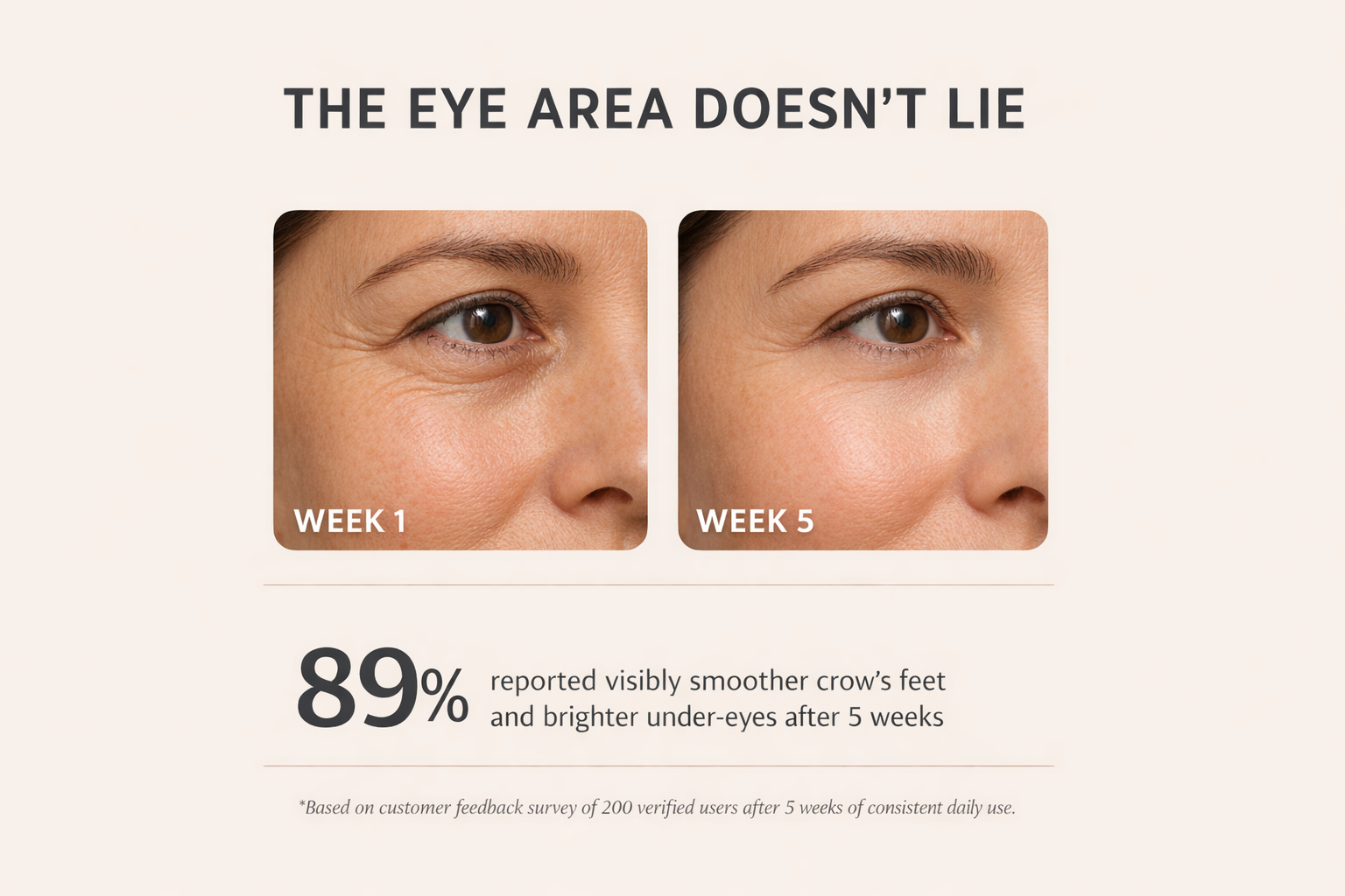 Elvorie™ EyeLift Pro