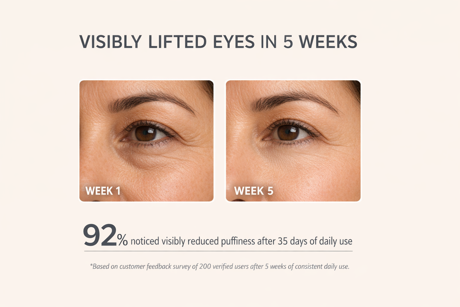 Elvorie™ EyeLift Pro